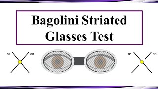 Bagolini Striated Glasses Test [upl. by Dyche973]